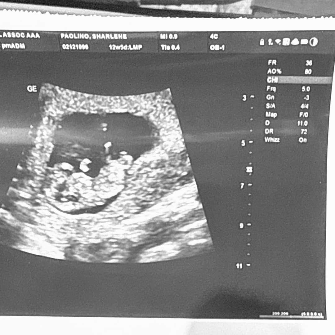 Photo shared by Sharlene for their Babylist baby registry.