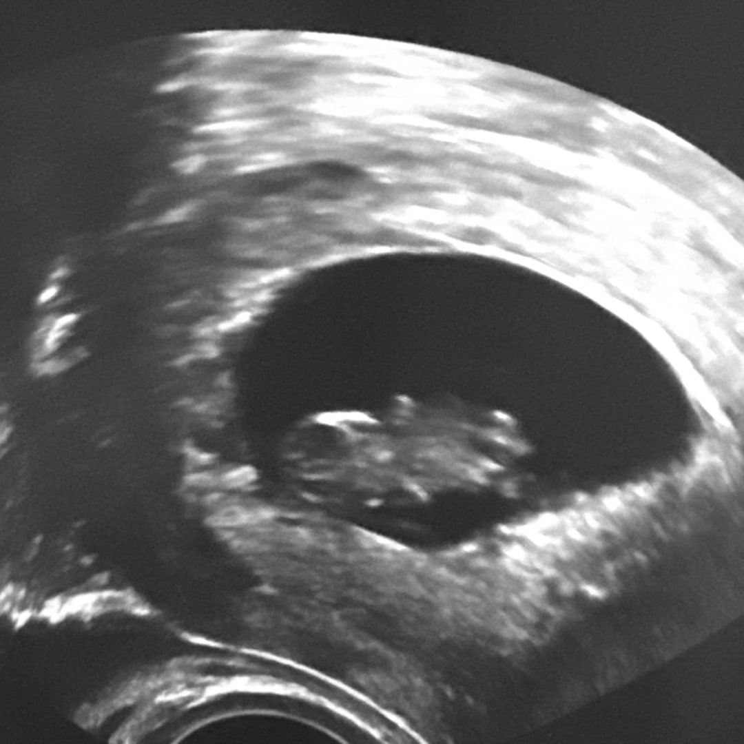 Photo shared by Allie for their Babylist baby registry.