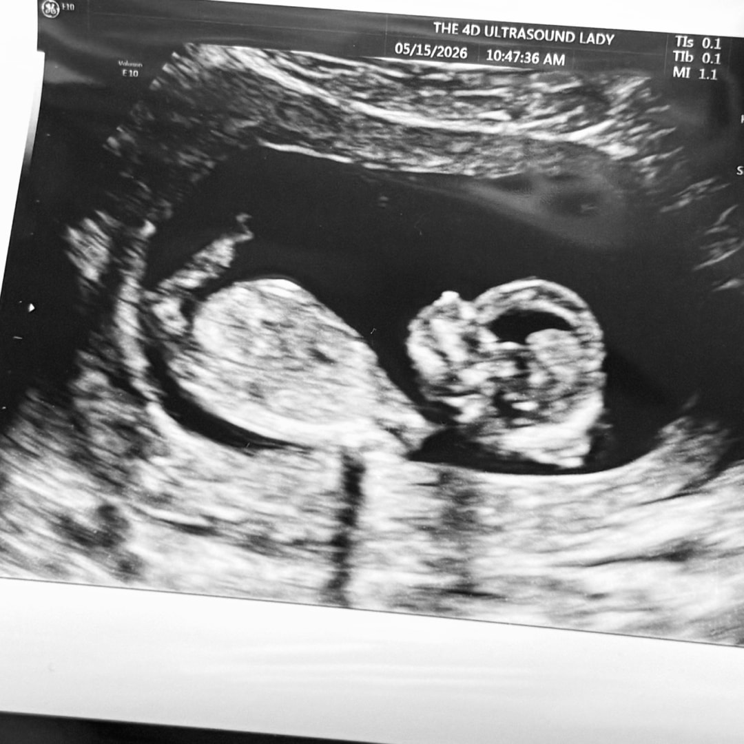 Photo shared by Lilliane for their Babylist baby registry.