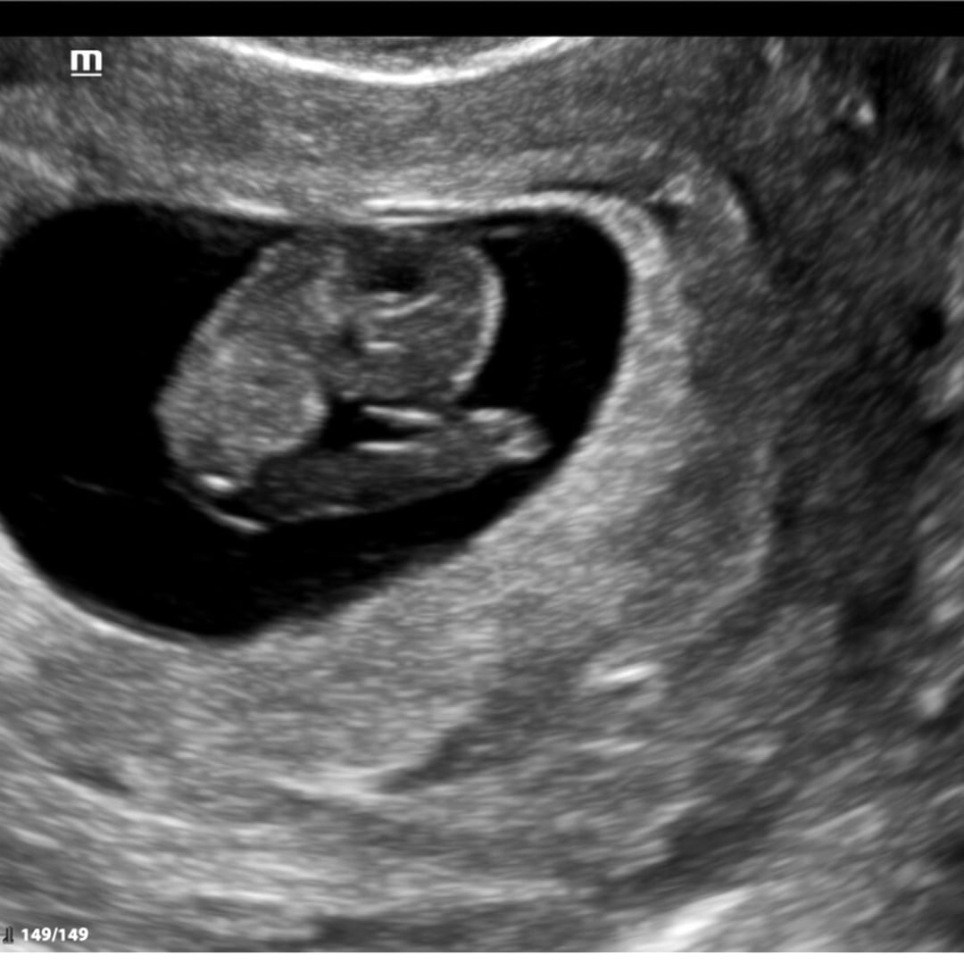 Photo shared by Courtney for their Babylist baby registry.