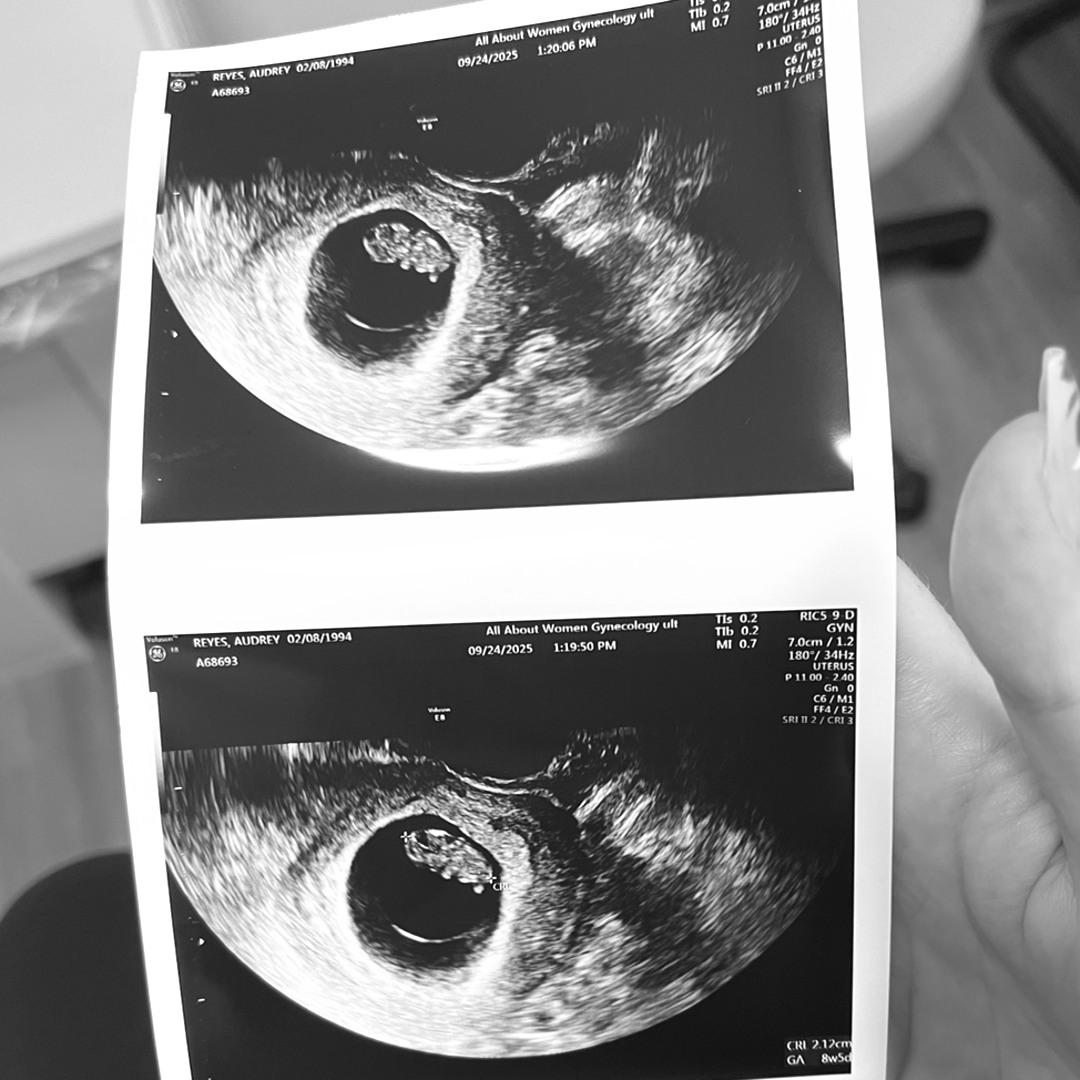 Photo shared by Audrey for their Babylist baby registry.