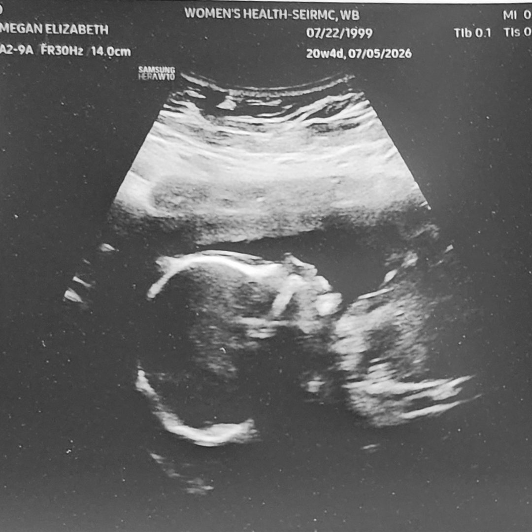Photo shared by Megan for their Babylist baby registry.