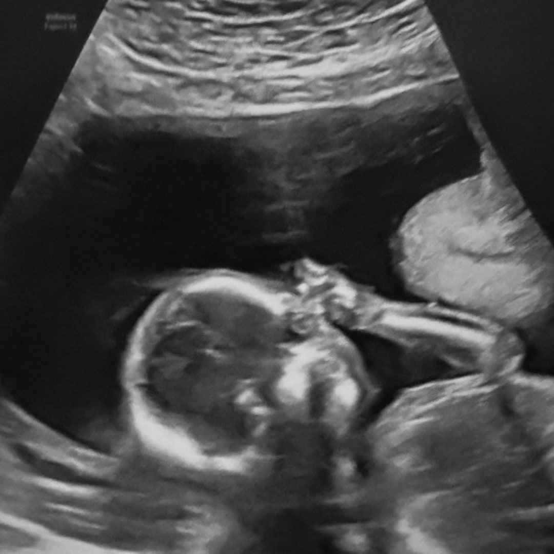 Photo shared by Heartlyn for their Babylist baby registry.