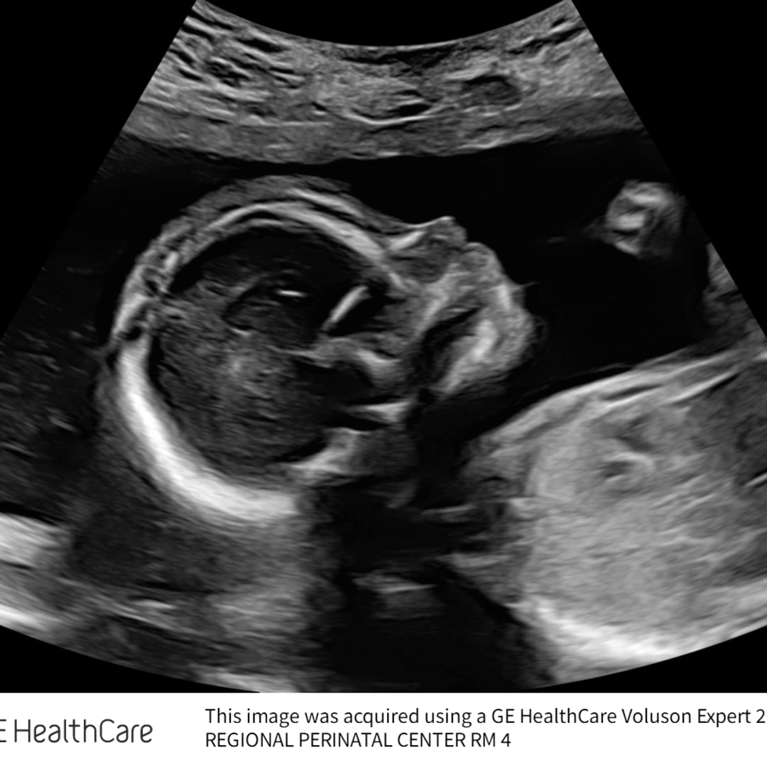 Photo shared by Harley for their Babylist baby registry.