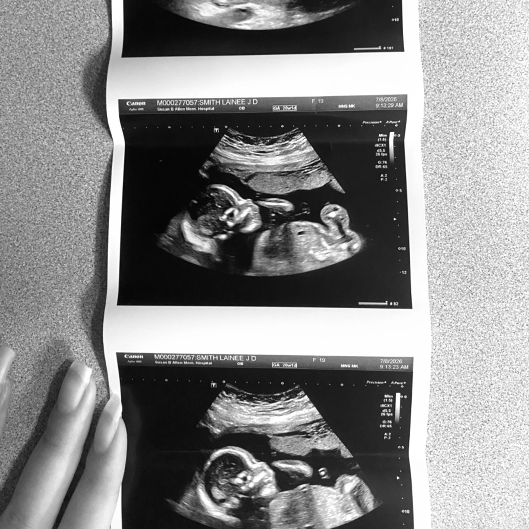 Photo shared by Lainee for their Babylist baby registry.