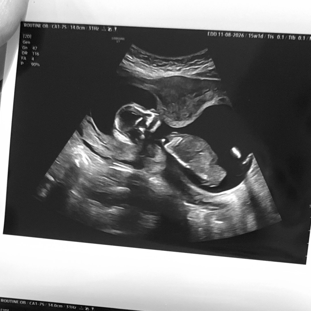Photo shared by Christina & Sean for their Babylist baby registry.