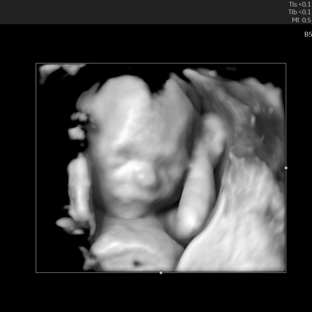 Photo shared by Deidra for their Babylist baby registry.
