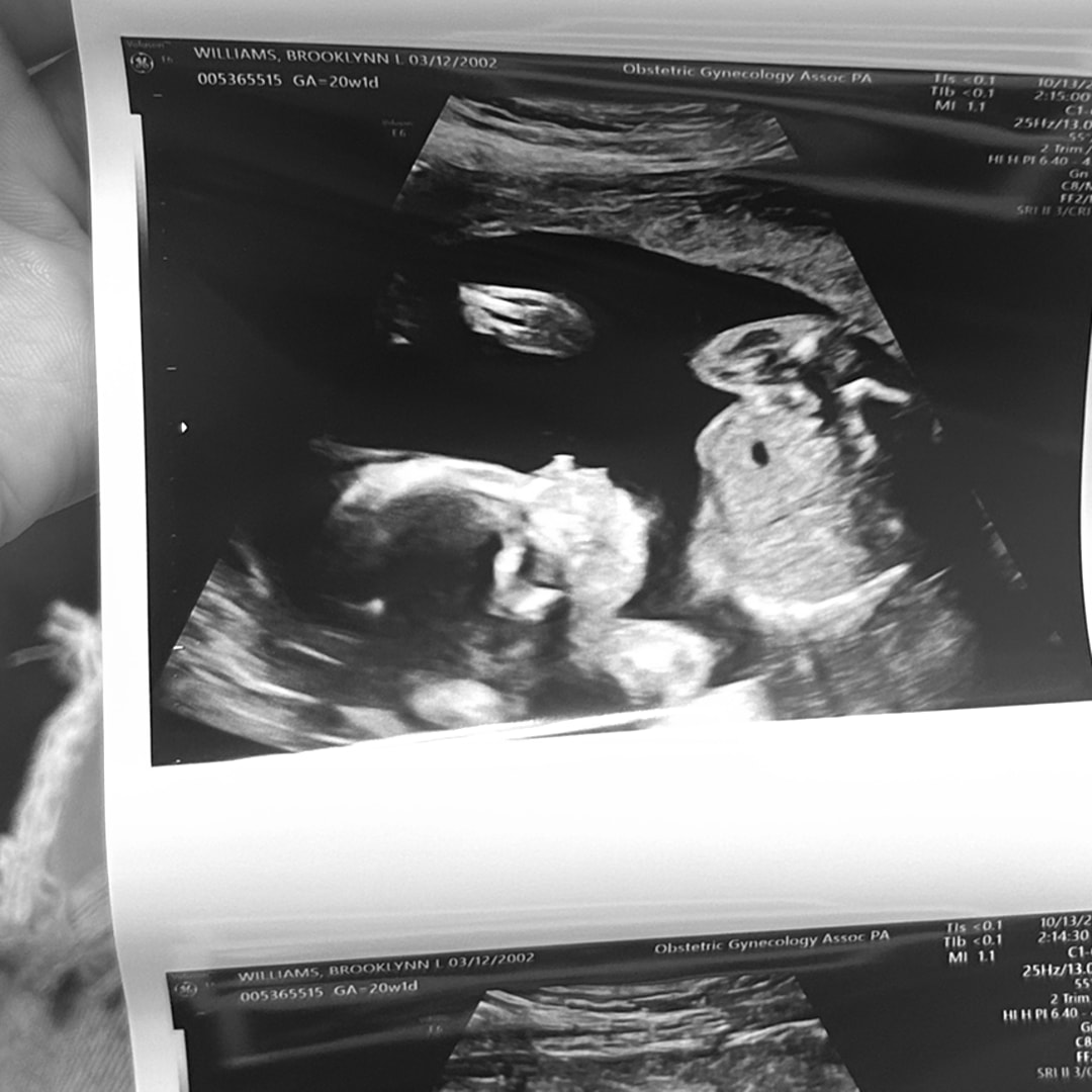 Photo shared by Brooklynn for their Babylist baby registry.