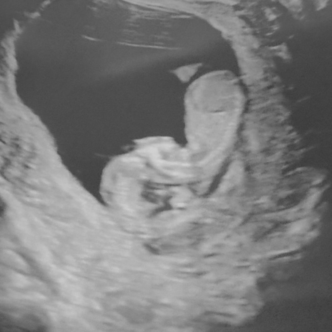 Photo shared by Elizabeth for their Babylist baby registry.