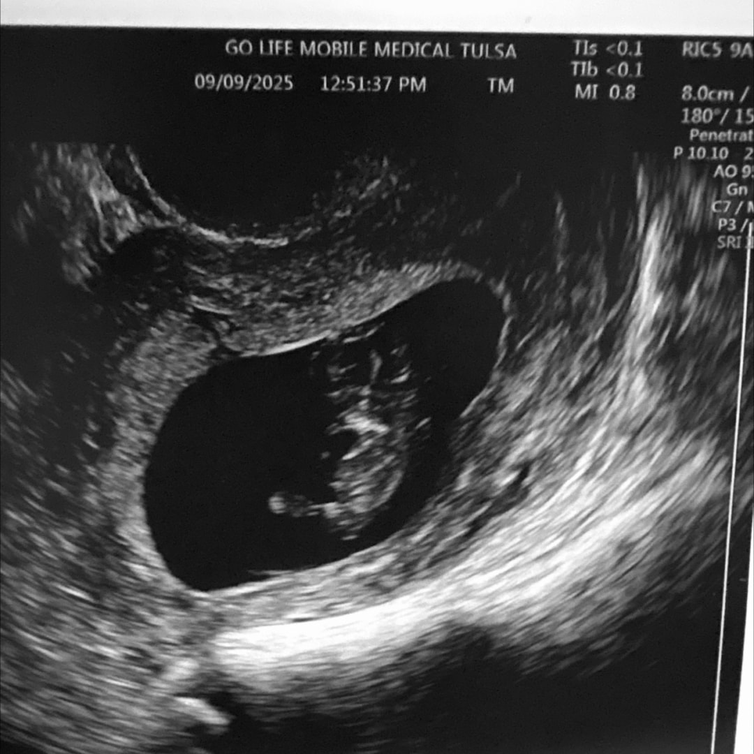 Photo shared by Shayla for their Babylist baby registry.