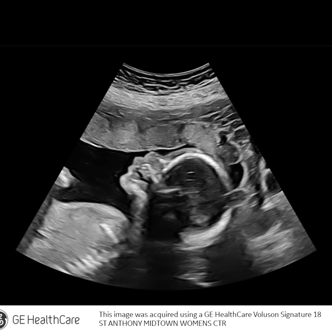 Photo shared by Shauna for their Babylist baby registry.