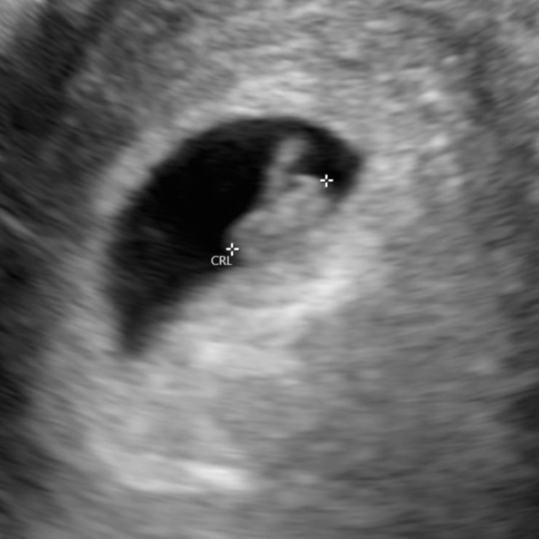 Photo shared by Emani for their Babylist baby registry.