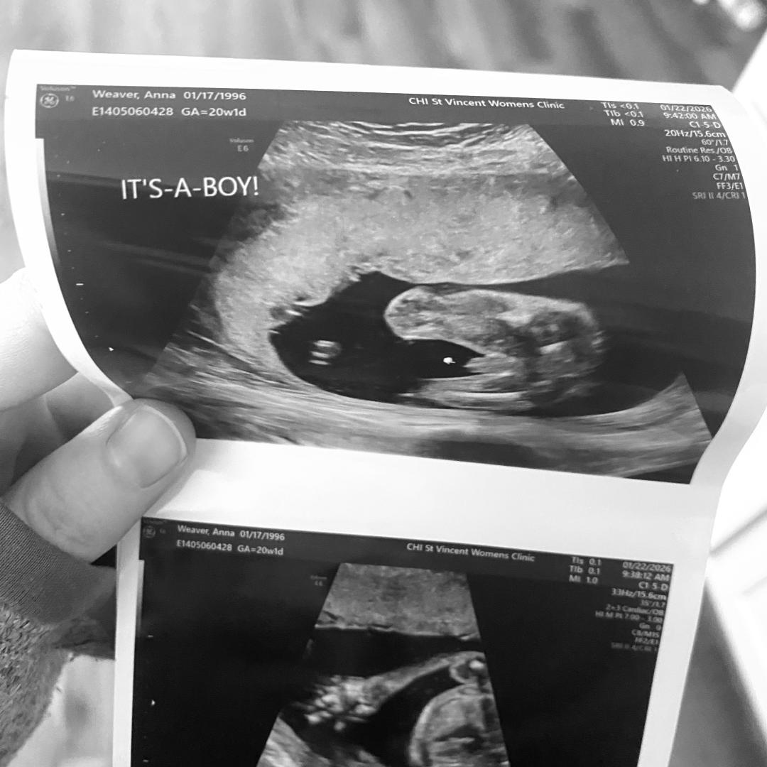Photo shared by Annie for their Babylist baby registry.