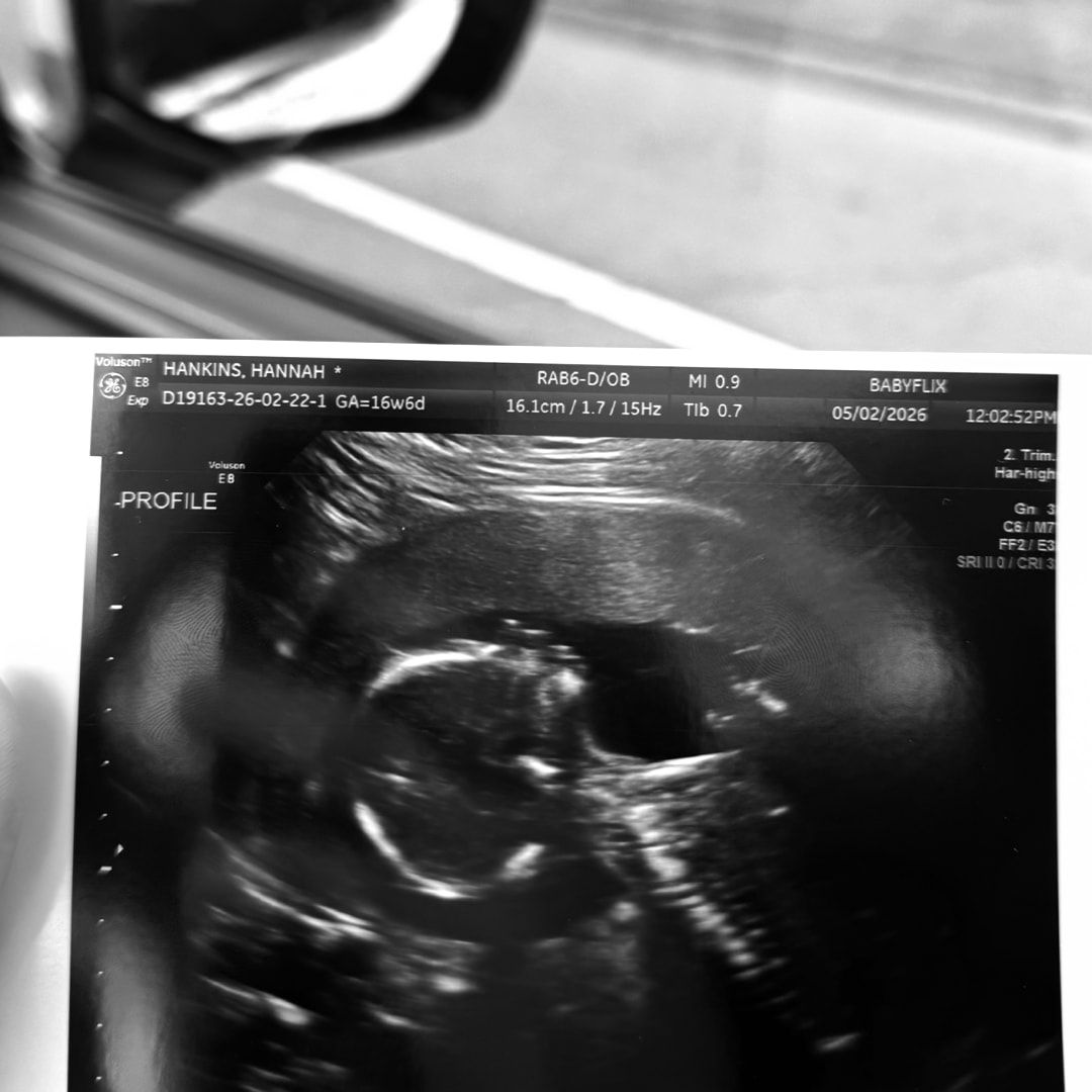 Photo shared by Hannah for their Babylist baby registry.