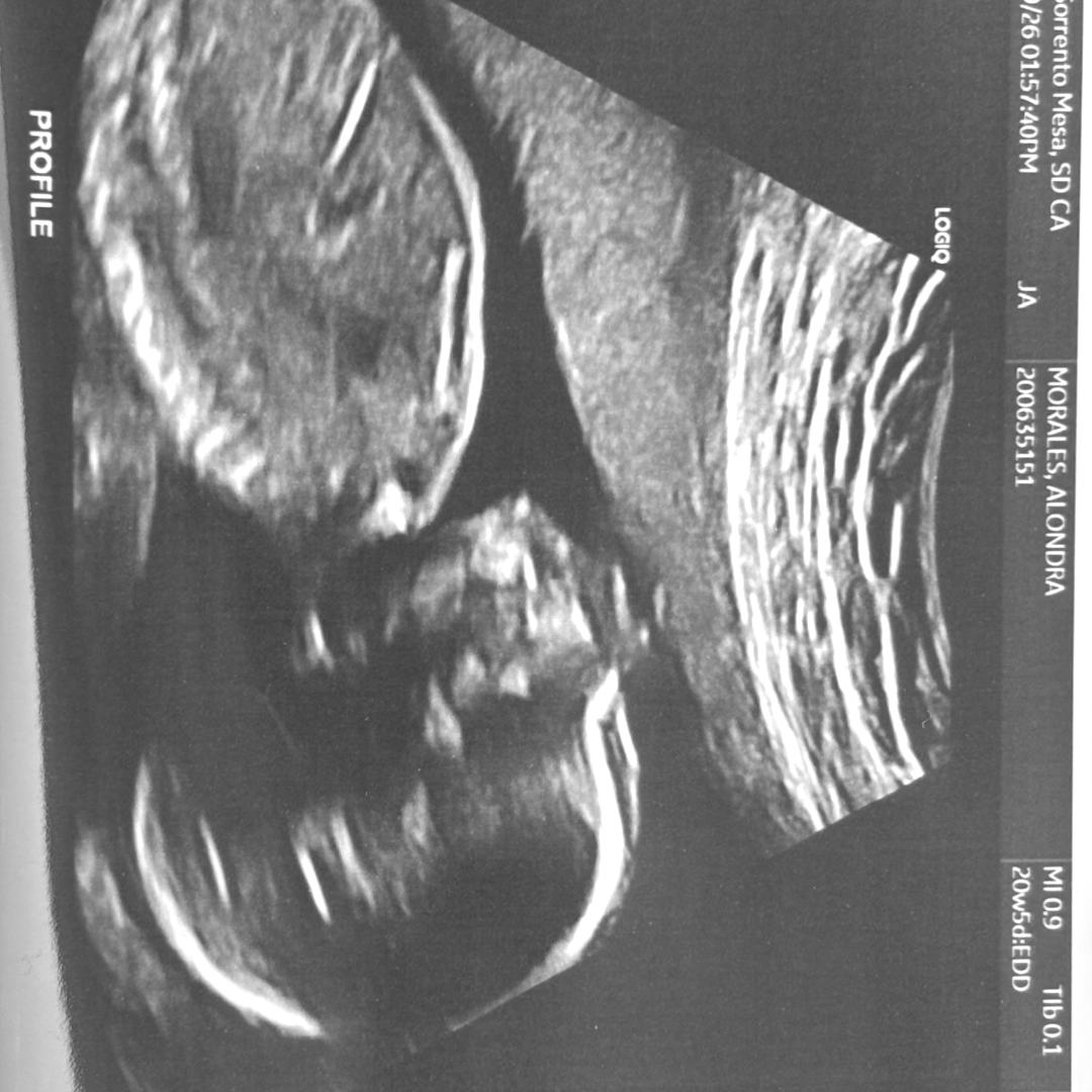 Photo shared by Alondra for their Babylist baby registry.