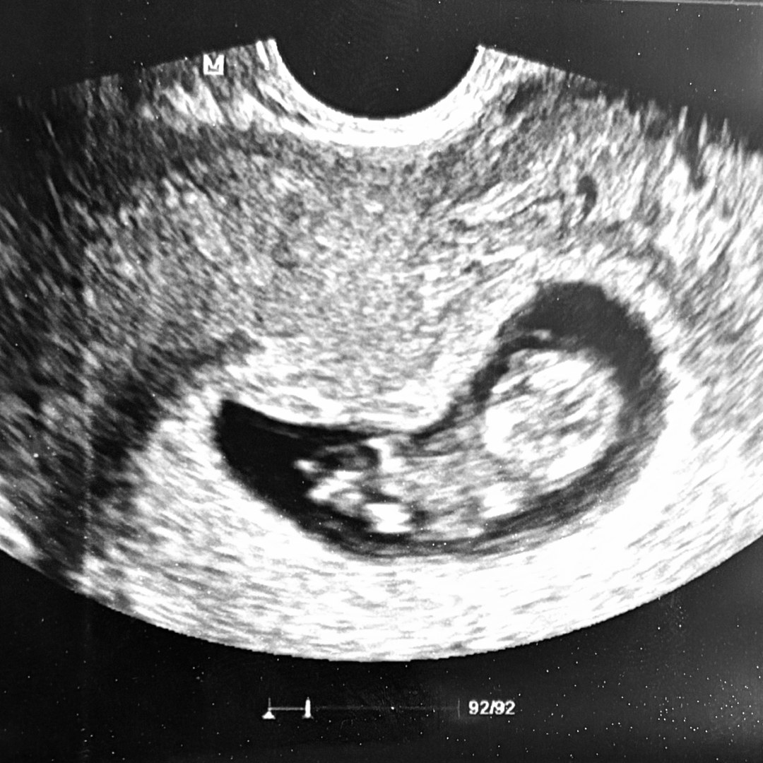 Photo shared by Layla for their Babylist baby registry.