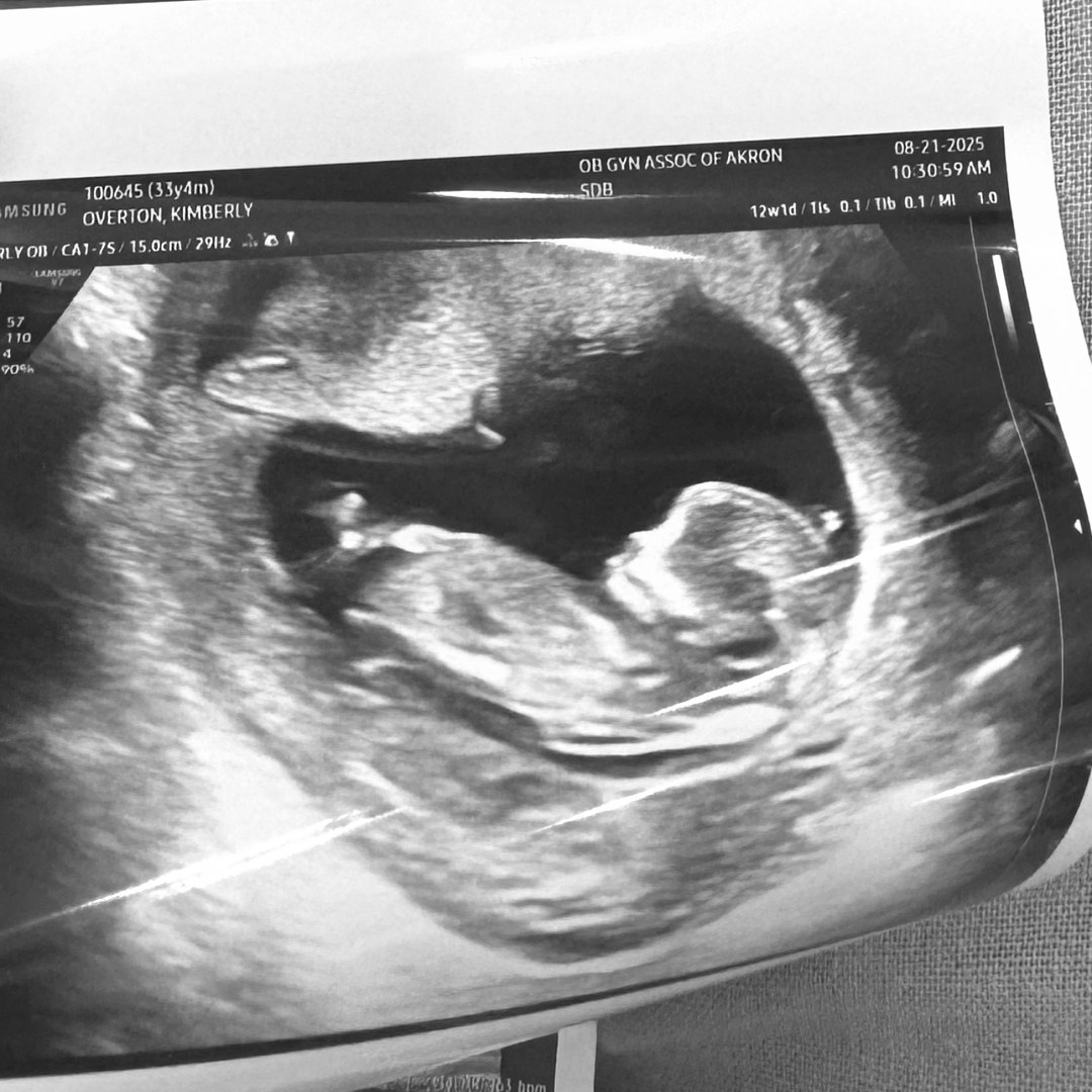 Photo shared by Kimberly for their Babylist baby registry.
