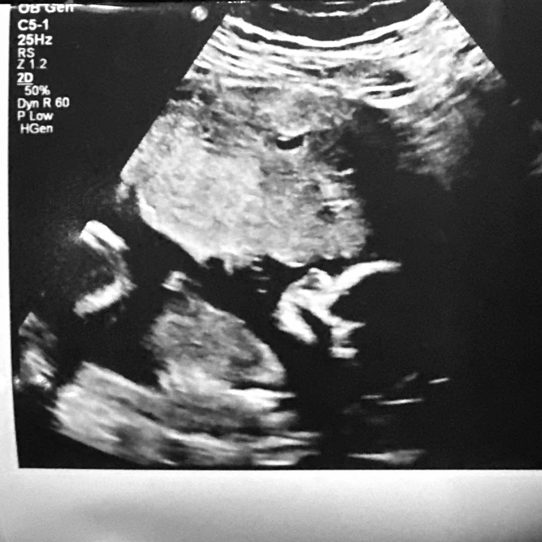 Photo shared by Angeles for their Babylist baby registry.