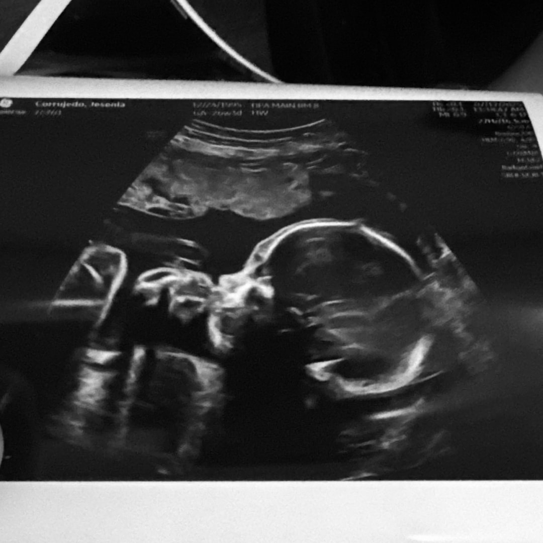 Photo shared by Jesenia for their Babylist baby registry.