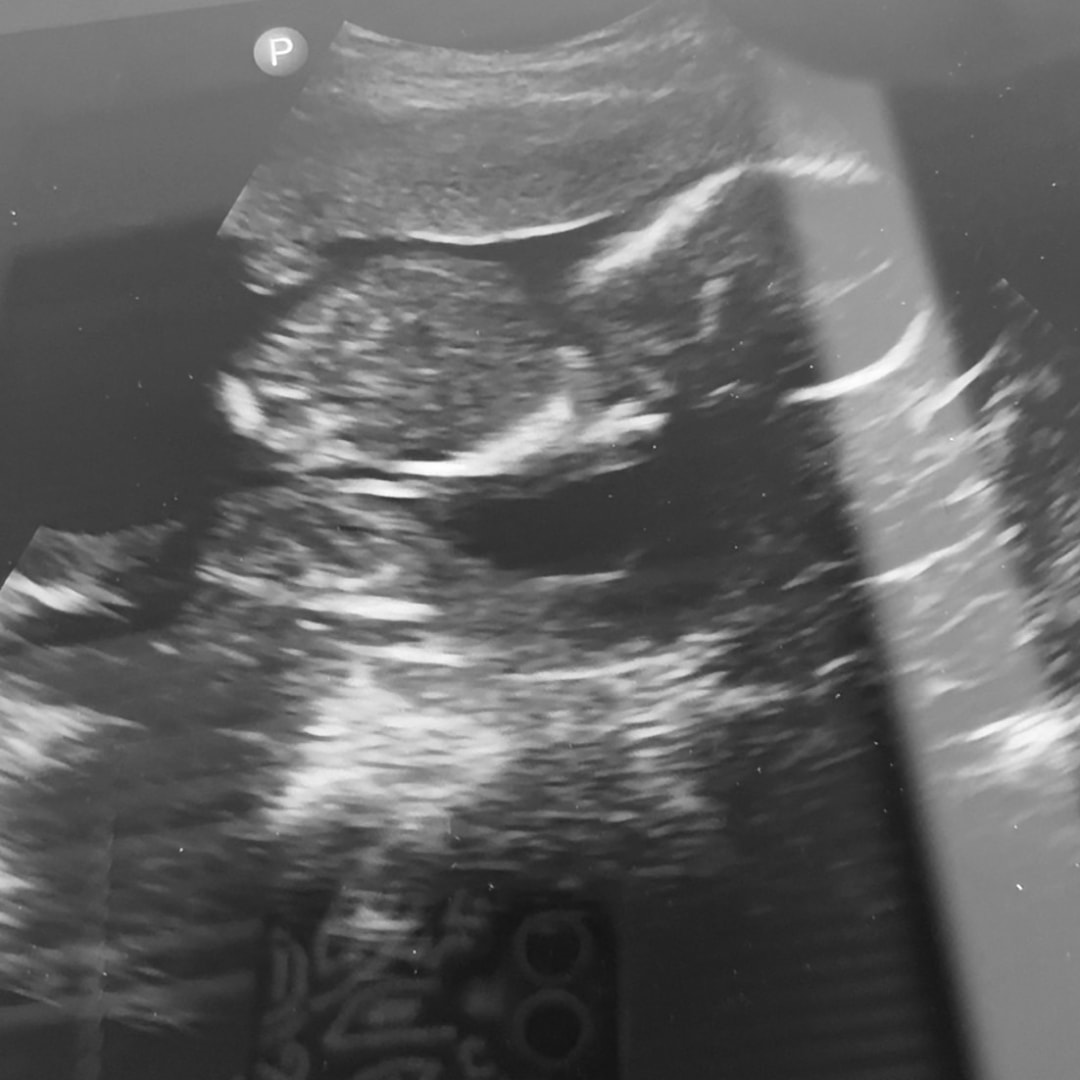 Photo shared by Dorisa for their Babylist baby registry.