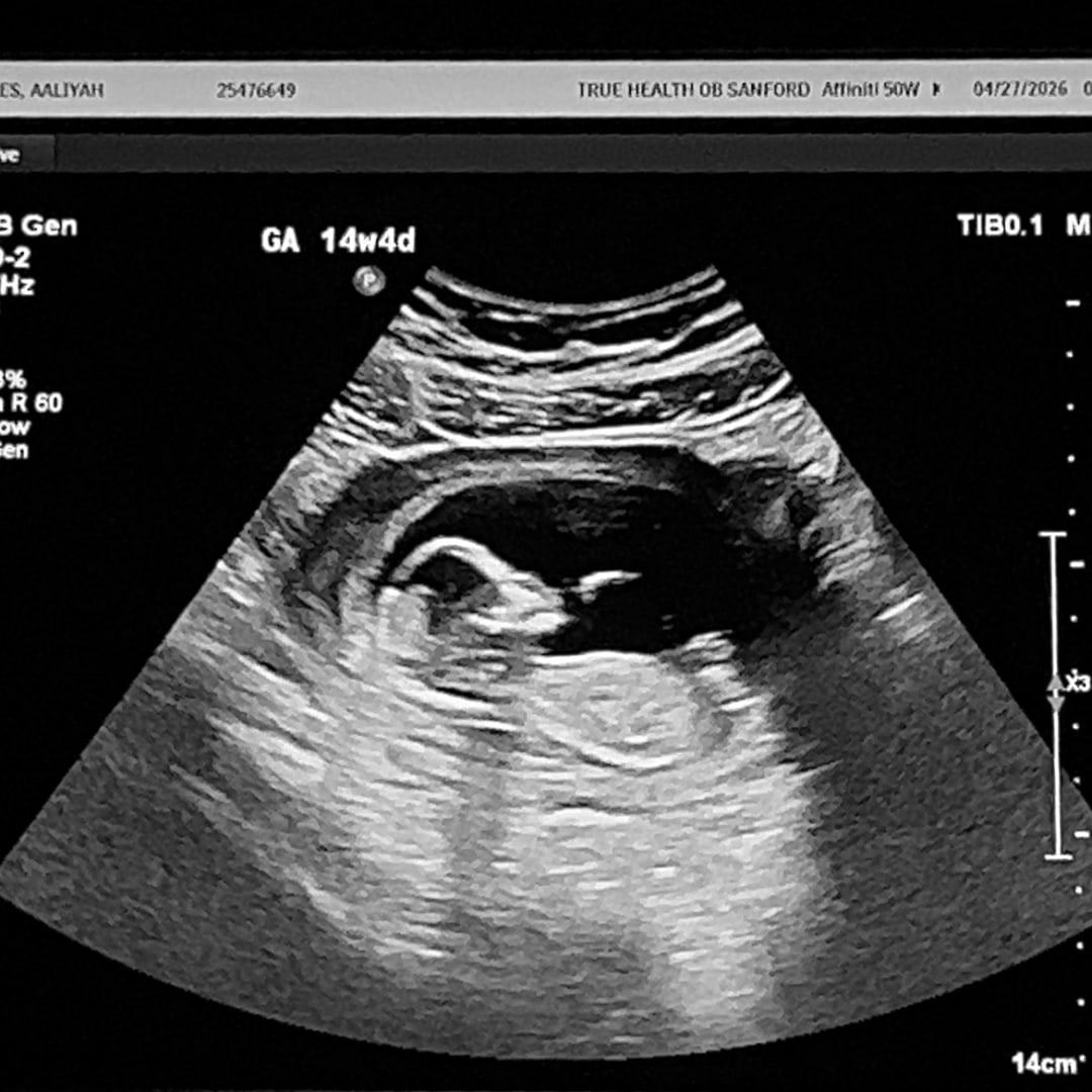 Photo shared by Aaliyah for their Babylist baby registry.