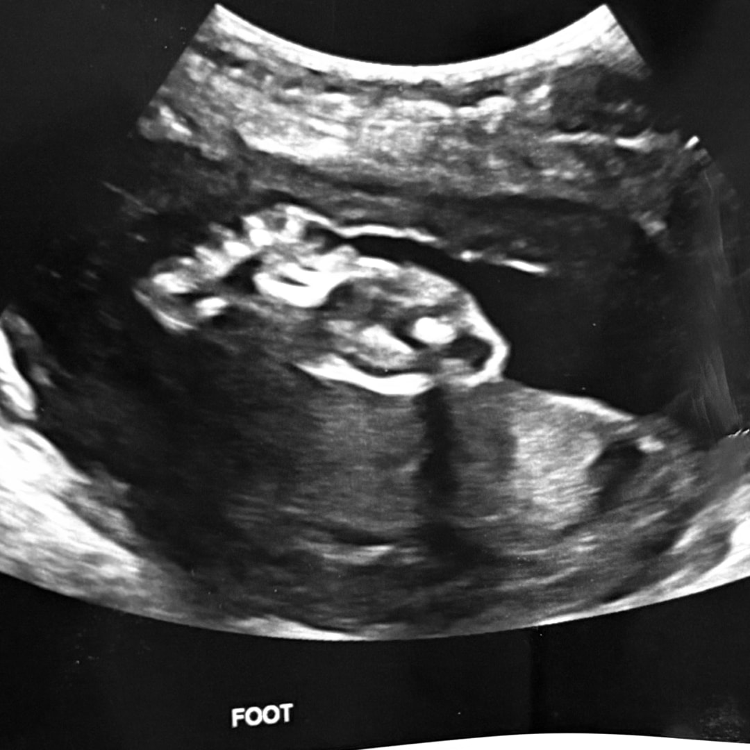 Photo shared by Pichaya for their Babylist baby registry.