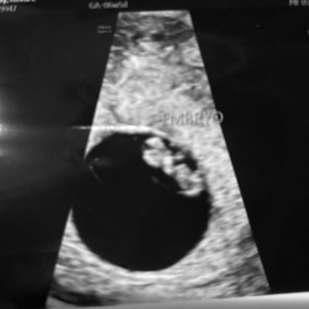 Photo shared by Alivia for their Babylist baby registry.