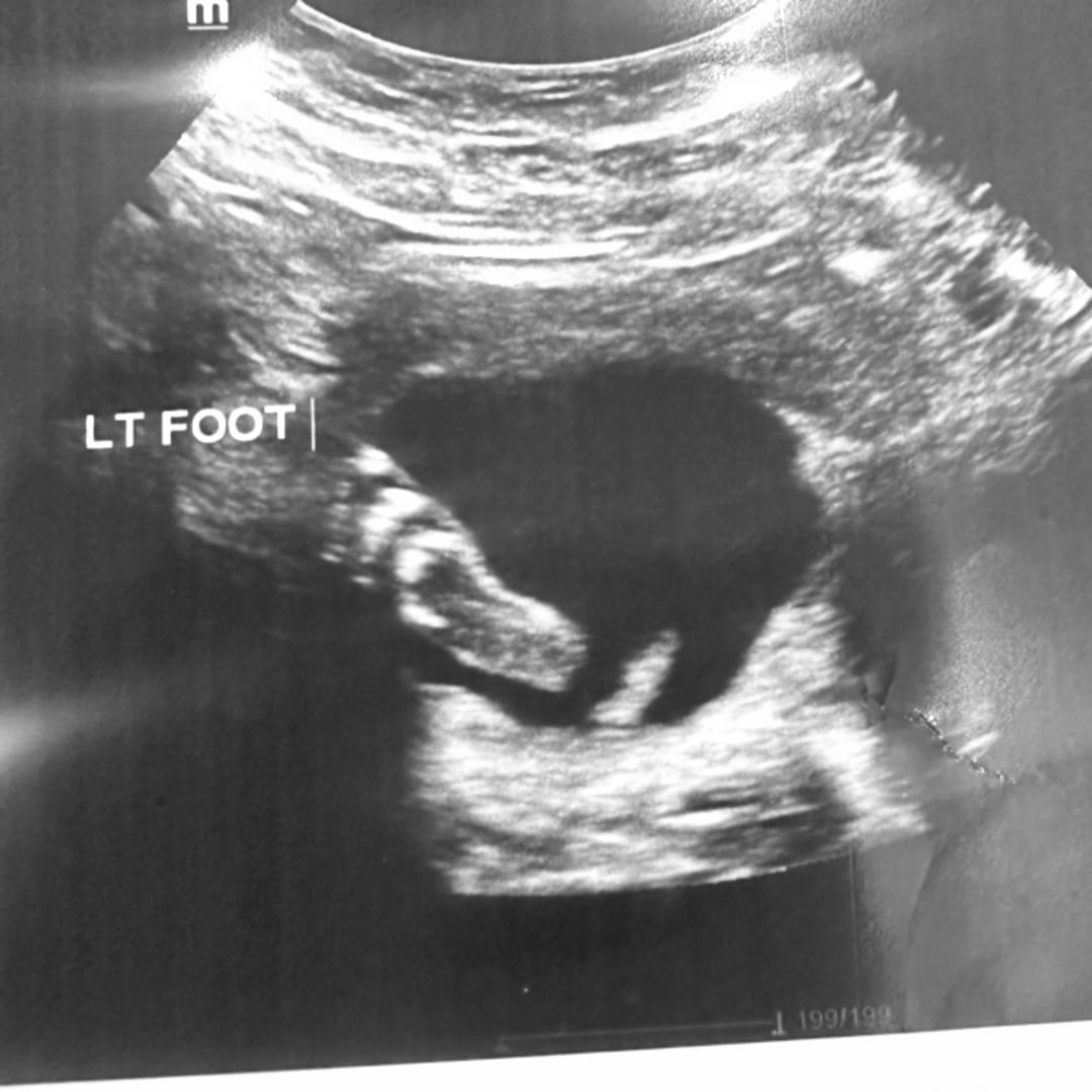 Photo shared by Ashley for their Babylist baby registry.