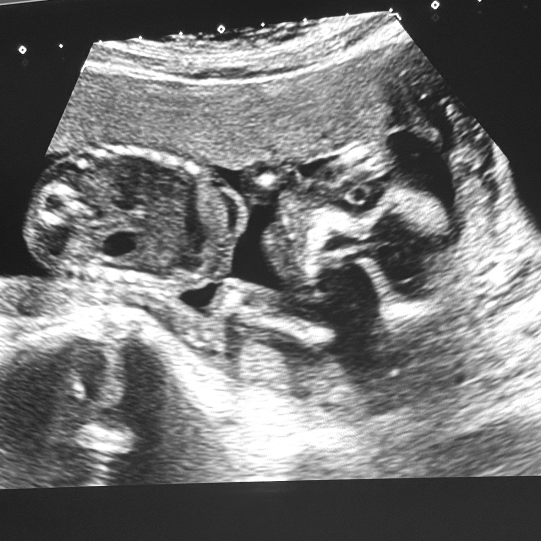 Photo shared by Brooke-Lynn for their Babylist baby registry.