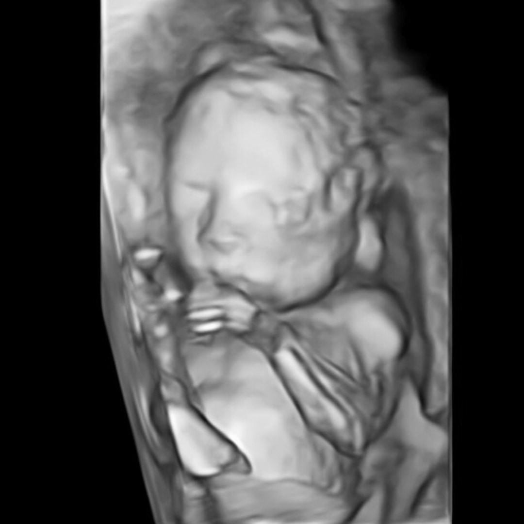 Photo shared by Aleksa for their Babylist baby registry.