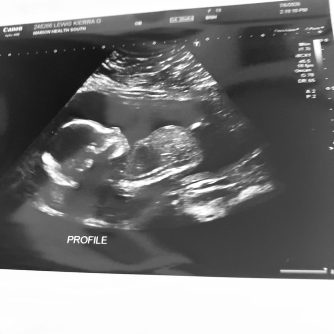 Photo shared by Kierra for their Babylist baby registry.