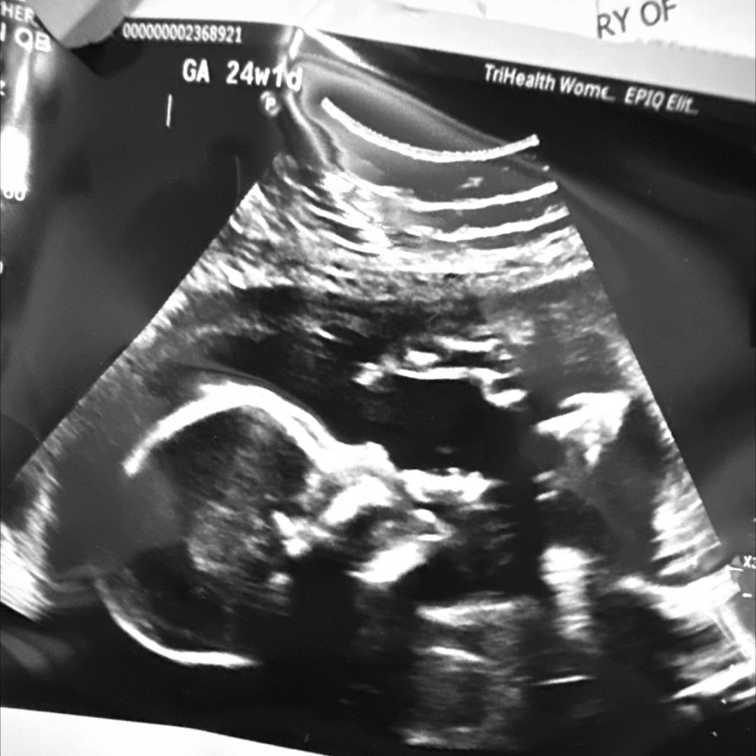 Photo shared by Alexandra for their Babylist baby registry.