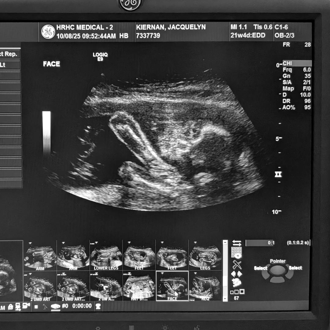 Photo shared by Jacquelyn for their Babylist baby registry.