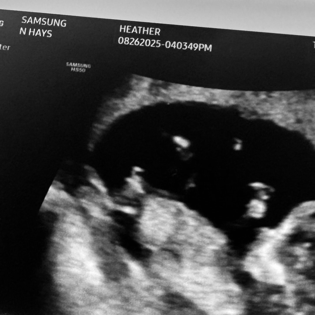Photo shared by HEATHER for their Babylist baby registry.