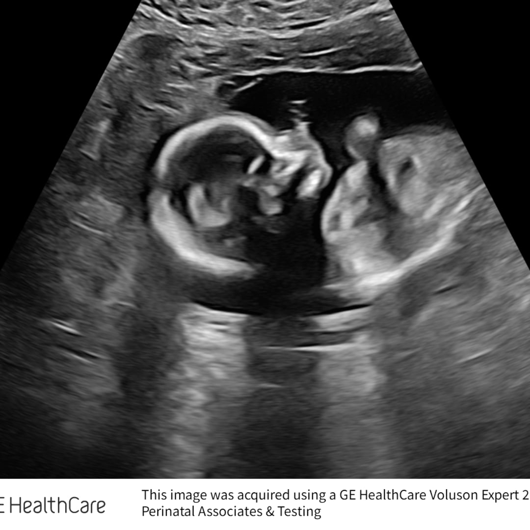 Photo shared by Whitney for their Babylist baby registry.