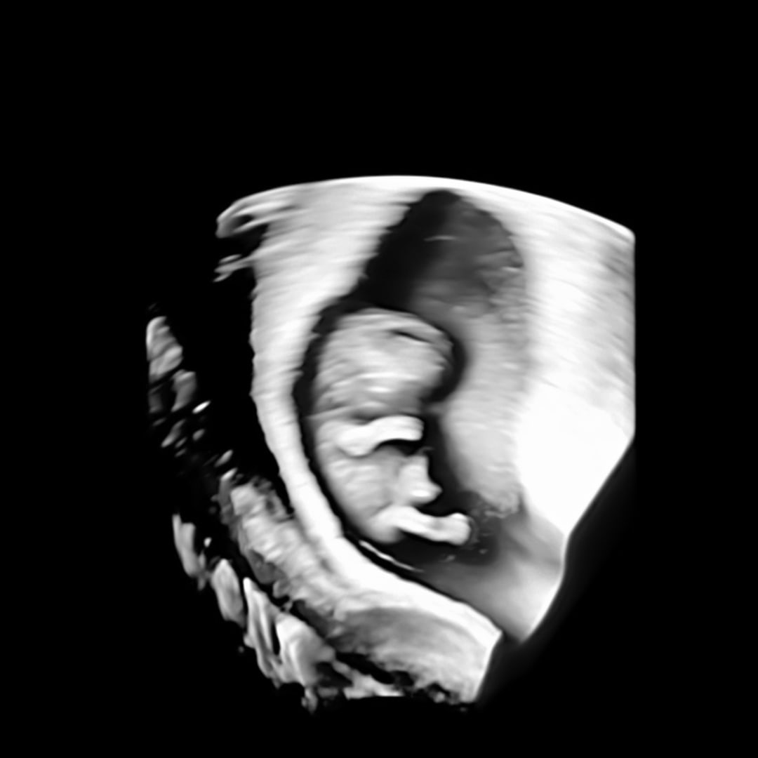 Photo shared by Katelyn for their Babylist baby registry.