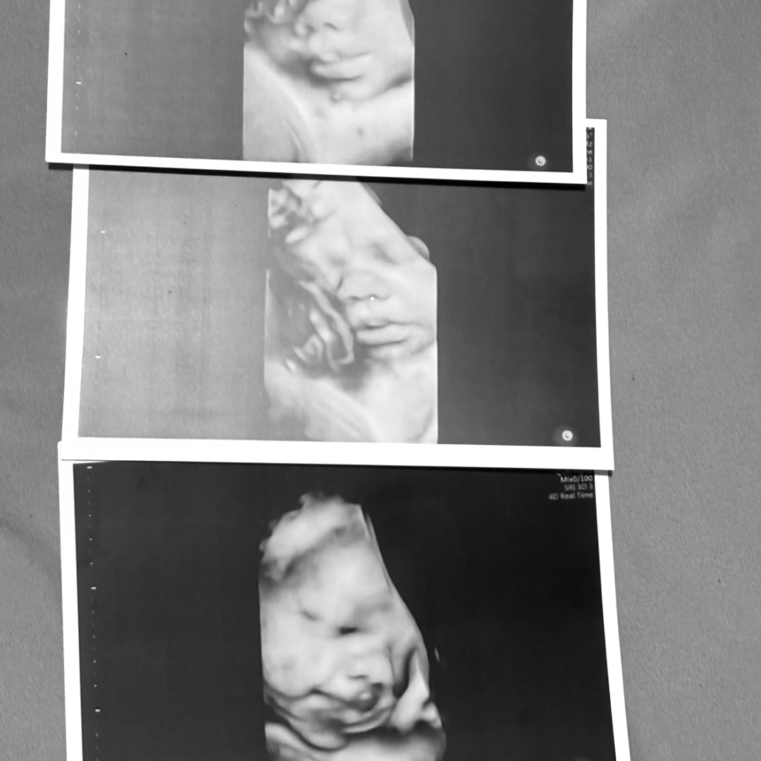 Photo shared by Catherine for their Babylist baby registry.