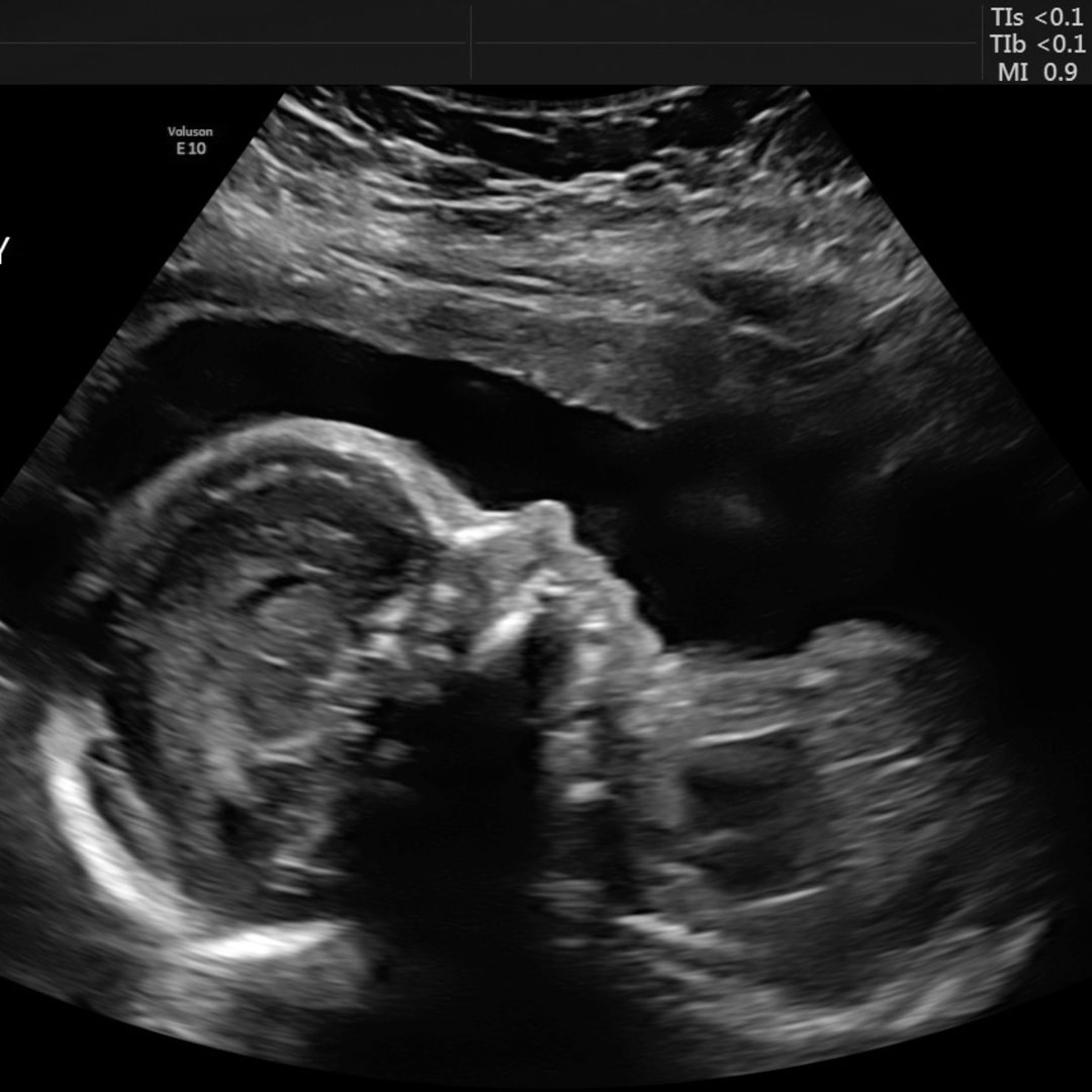 Photo shared by Lindsey for their Babylist baby registry.