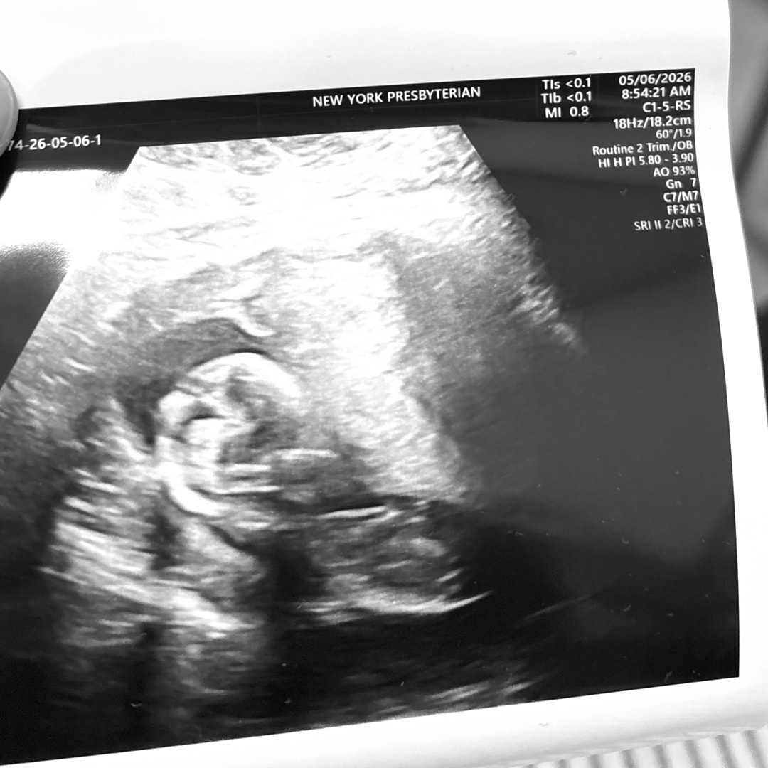 Photo shared by Aniya for their Babylist baby registry.