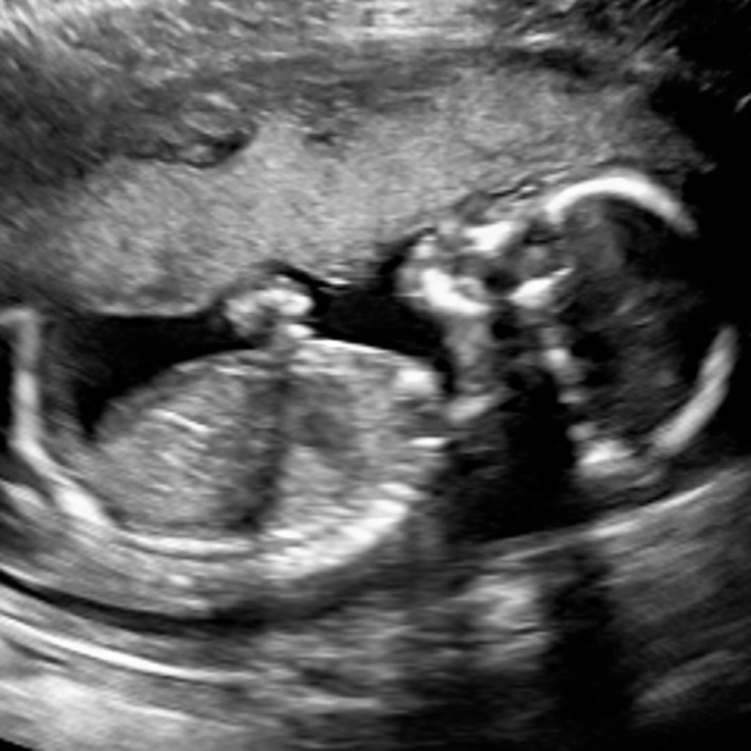 Photo shared by Ashleigh for their Babylist baby registry.