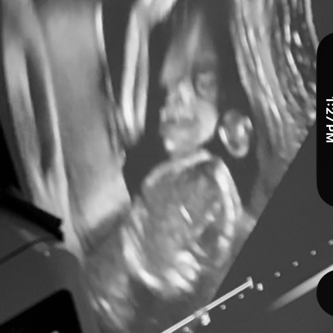 Photo shared by Alora for their Babylist baby registry.