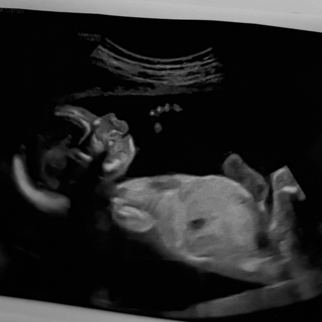 Photo shared by Amy for their Babylist baby registry.