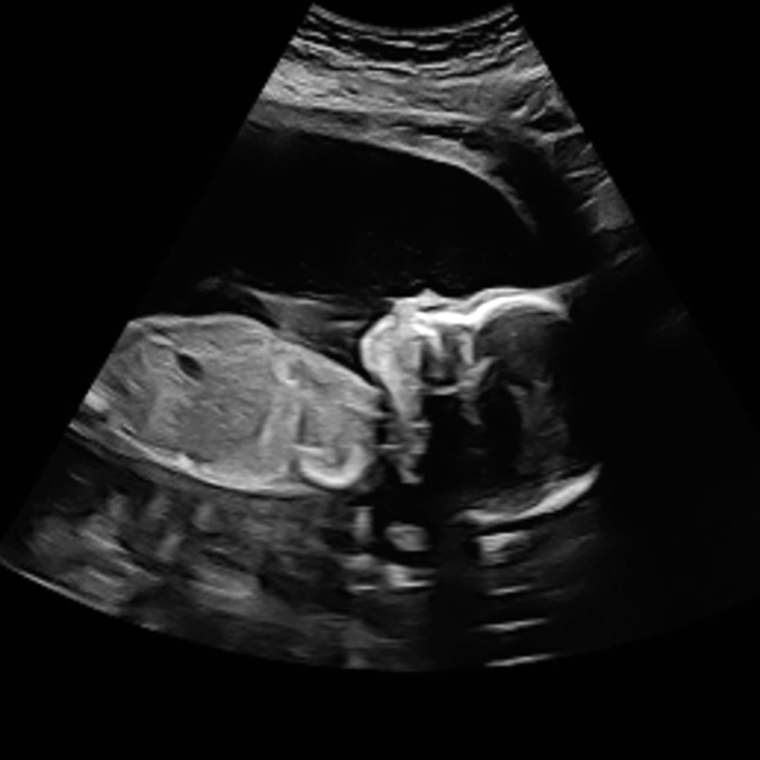 Photo shared by Stephanie for their Babylist baby registry.