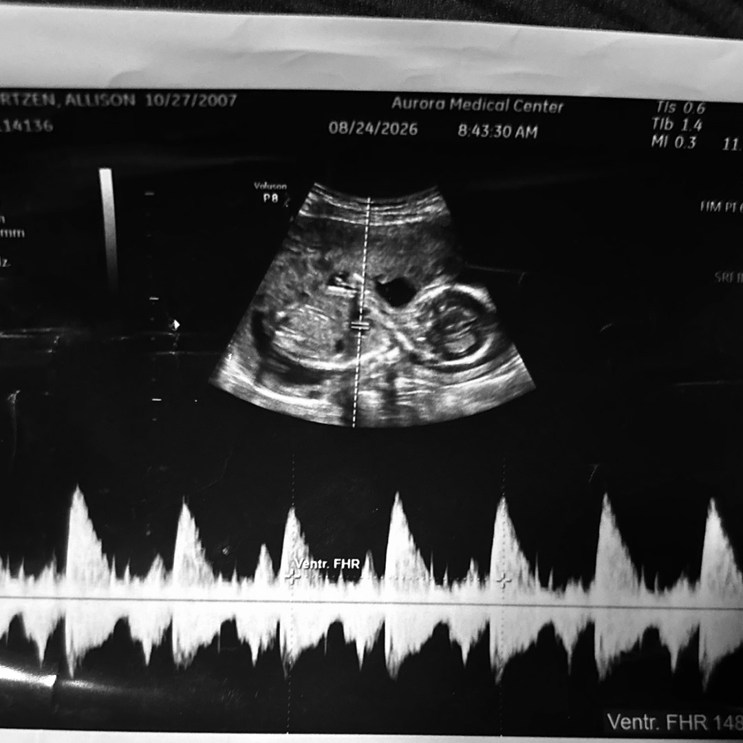 Photo shared by Allison for their Babylist baby registry.