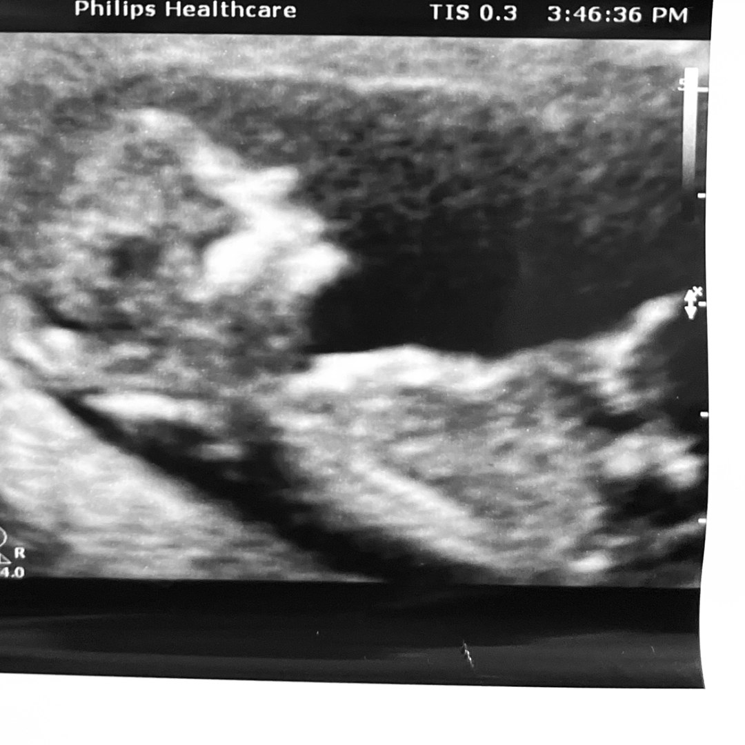 Photo shared by Charly for their Babylist baby registry.