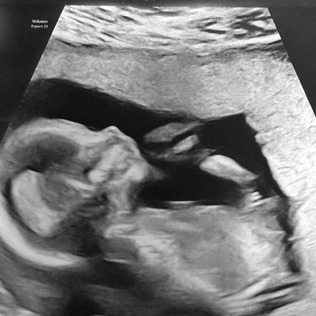 Photo shared by Priscila for their Babylist baby registry.