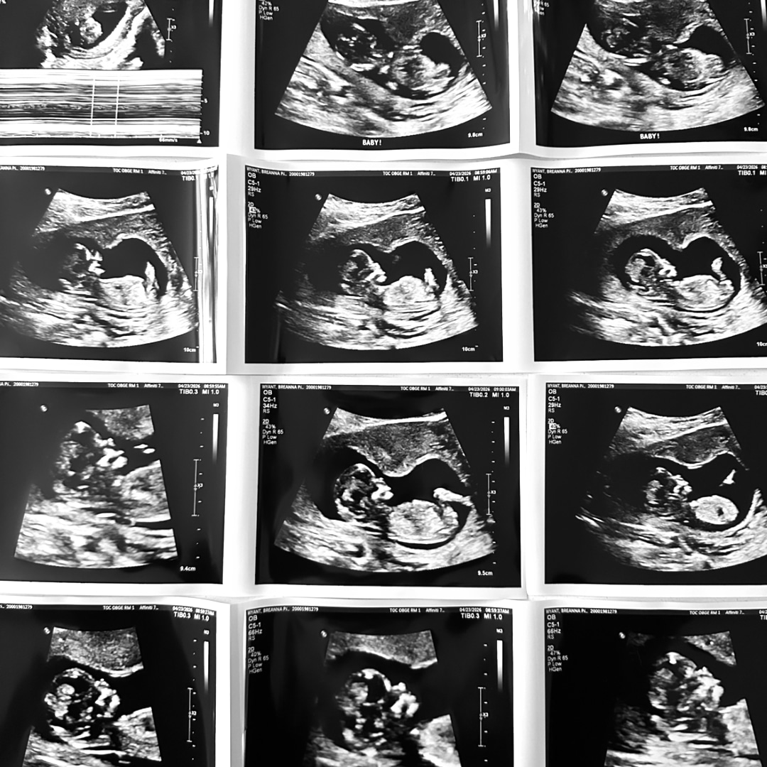 Photo shared by Breanna for their Babylist baby registry.