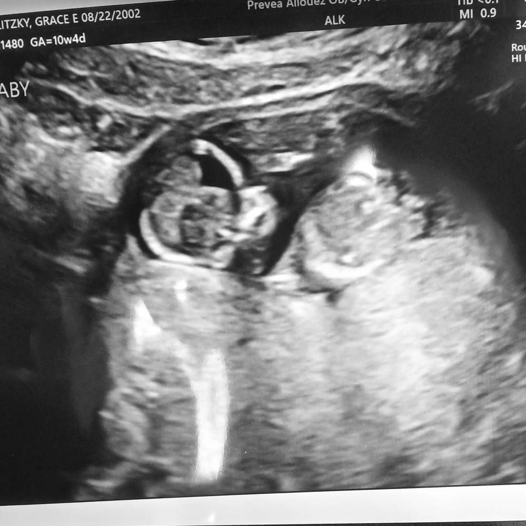 Photo shared by Grace for their Babylist baby registry.