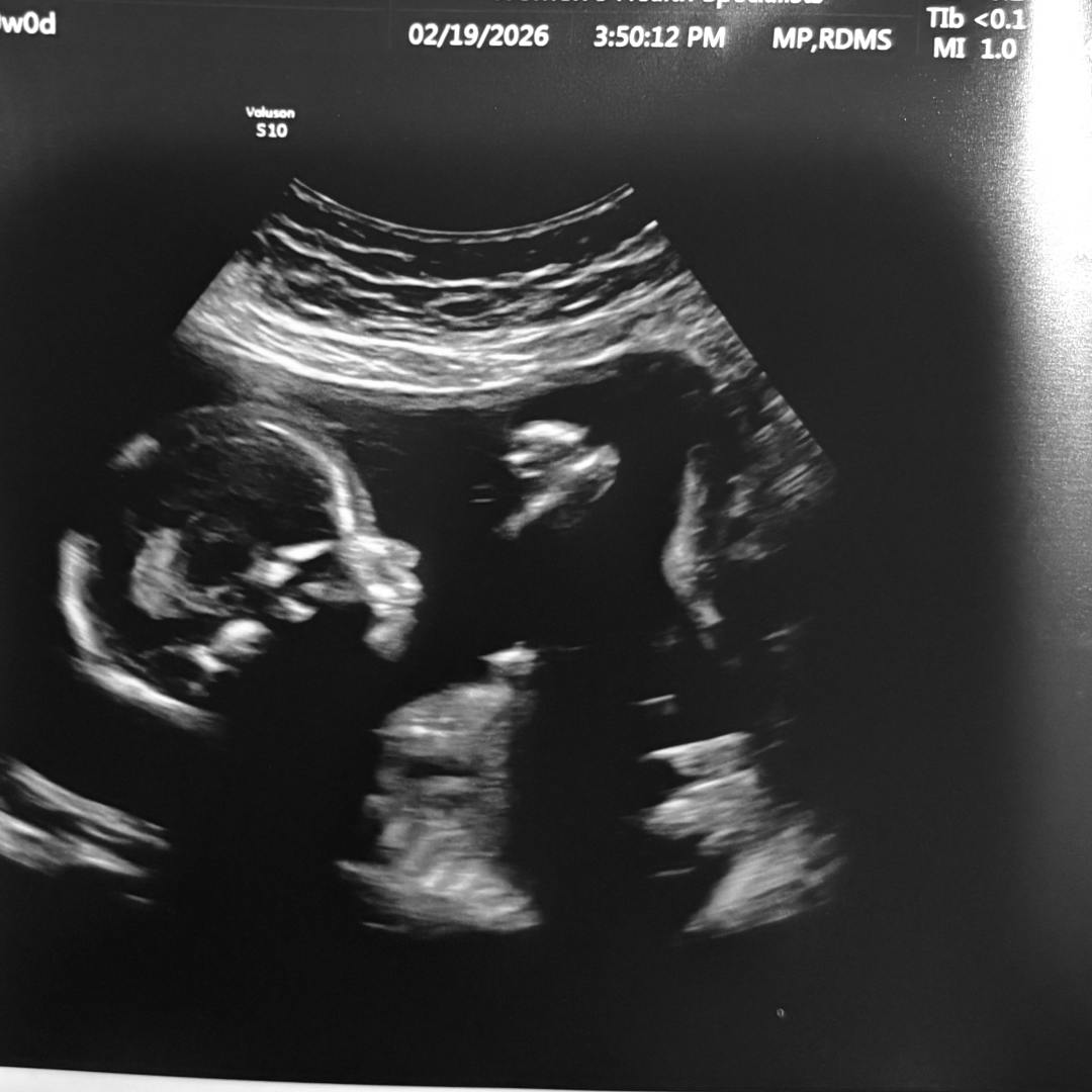 Photo shared by Jaden for their Babylist baby registry.