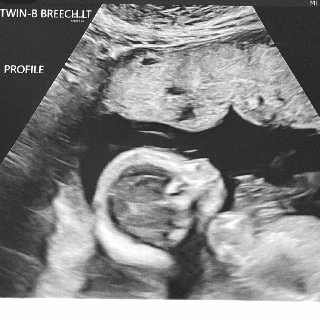 Photo shared by Mari for their Babylist baby registry.